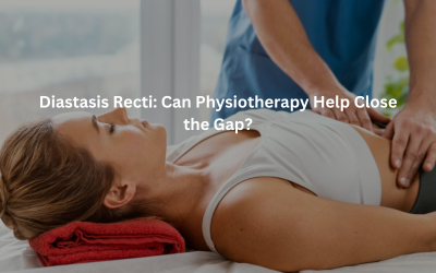 Diastasis Recti: Can Physiotherapy Help Close the Gap?